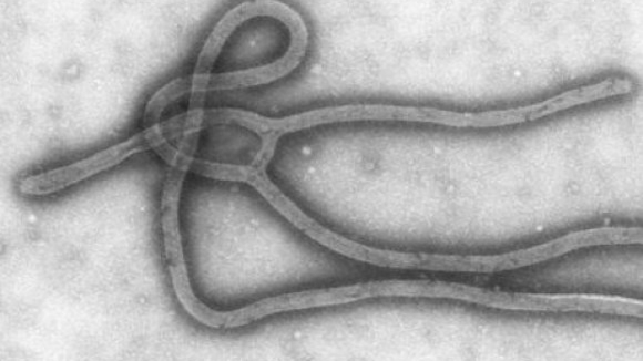 Viajantes contactam Linha Saúde 24 para pedir esclarecimentos sobre o Ébola