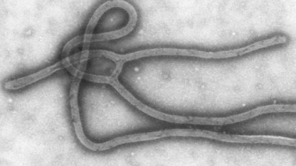 Autoridades portuguesas recomendam população a não viajar para países com ébola