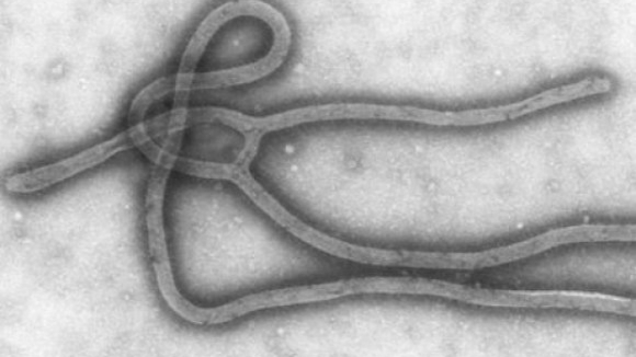 Ébola já matou 120 profissionais de Saúde