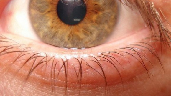 Cirurgias para mudança da cor dos olhos podem cegar