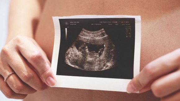 Parlamento aprova alterações à lei da interrupção voluntária da gravidez