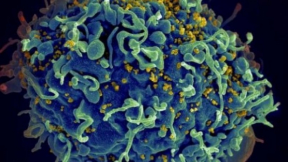 Medicamentos reduzem risco de transmissão de VIH em relações sexuais sem proteção
