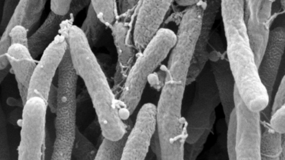 Bactéria ‘Xylella fastidiosa’ detetada em jardins particulares e espaços públicos de Gaia