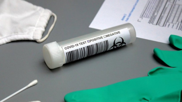 Diretores escolares pedem testes serológicos e terceira dose da vacina