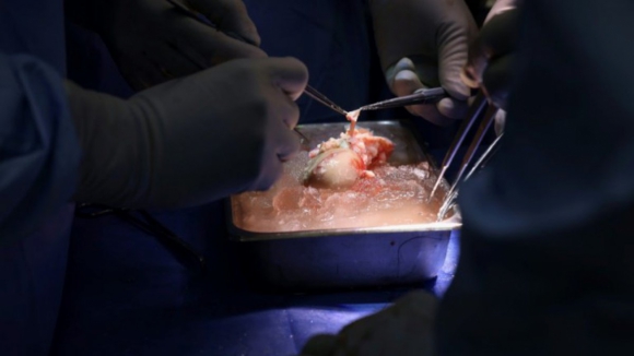Rim de porco transplantado pela primeira vez para um paciente vivo