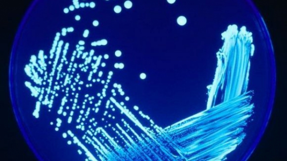 Legionella: Cinco mortos e 233 infectados