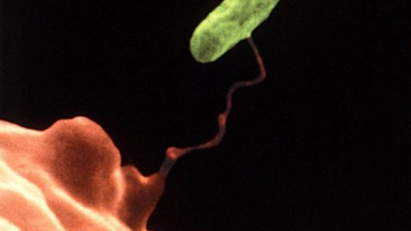 Legionella: Surto já provocou sete mortos