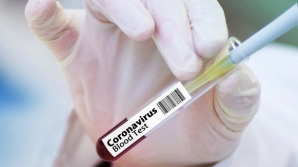 Covid-19: Alemanha vai avançar com ensaio clínico de vacina