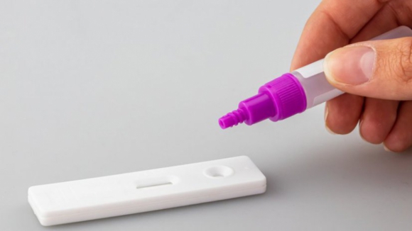 Testes rápidos de antigénio de uso profissional continuam gratuitos em fevereiro