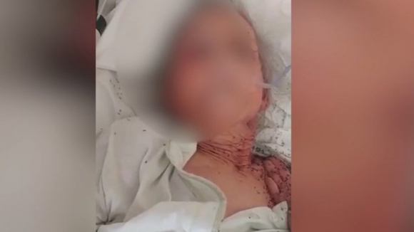 Idosa coberta de formigas e com ferida aberta em lar de Loul&eacute;