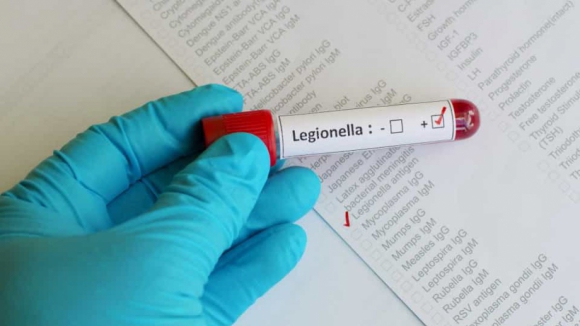 'Legionella' nos dois lados da fronteira. Galiza com nove infetados